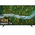 Smart Tivi LG 4K 65 inch 65UP7720PTC - Chính Hãng#5
